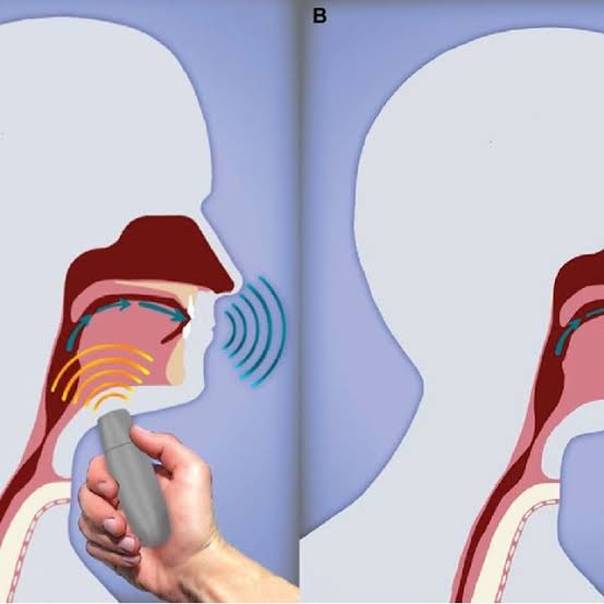 Online and Offline Speech Therapy