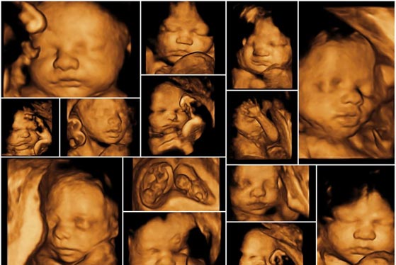 3D | 4D Sonography from Dr. Panchal Lab and Diagnostics Centre